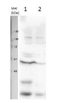 U1 snRNP protein A | U1 small nuclear ribonucleoprotein A in the group Antibodies Plant/Algal / DNA/RNA/Cell Cycle / RNA metabolism at Agrisera AB (Antibodies for research) (AS14 2777)